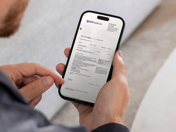 Testosteron thuis test uitslag op mobiel
